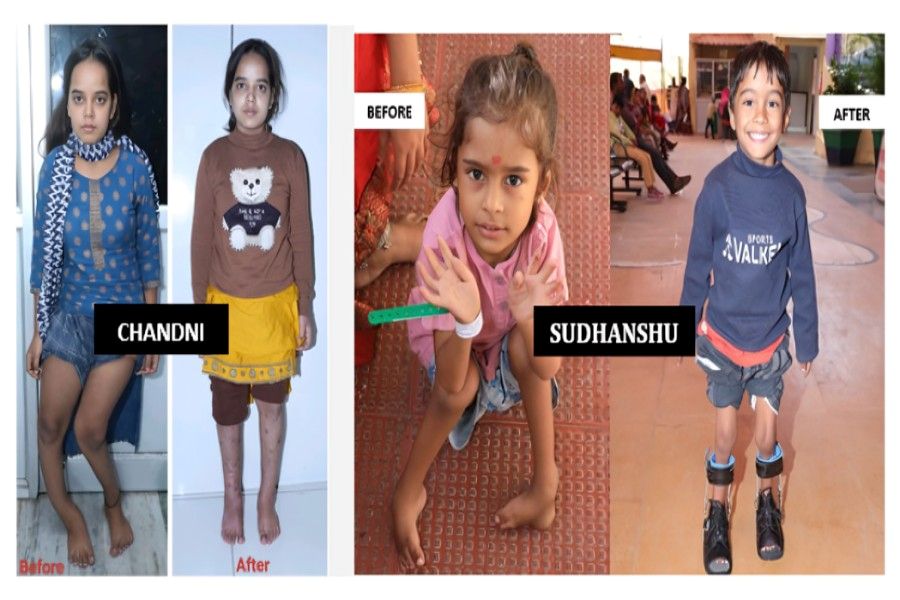 Narayan Seva Sansthan Performs Over 4.5 Lakh Free Surgeries, Expands Inclusive Healthcare Efforts
