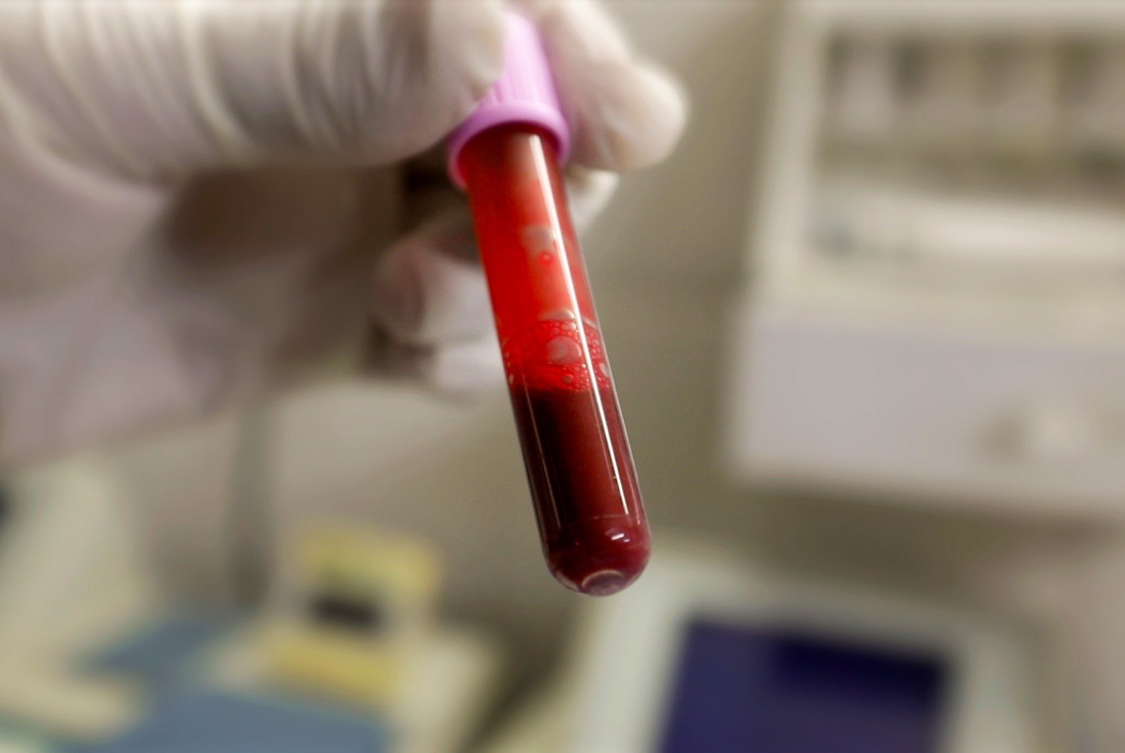 ‘Blood Fertiliser’: Unipads Launches Project To Dispel Taboos Around Menstruation